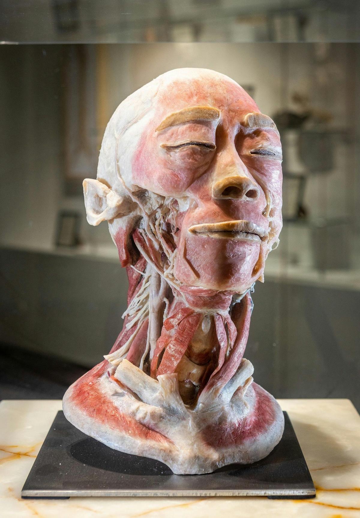Human head preserved by plastination