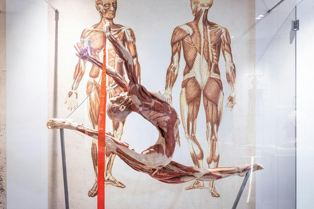 Human body preserved by plastination