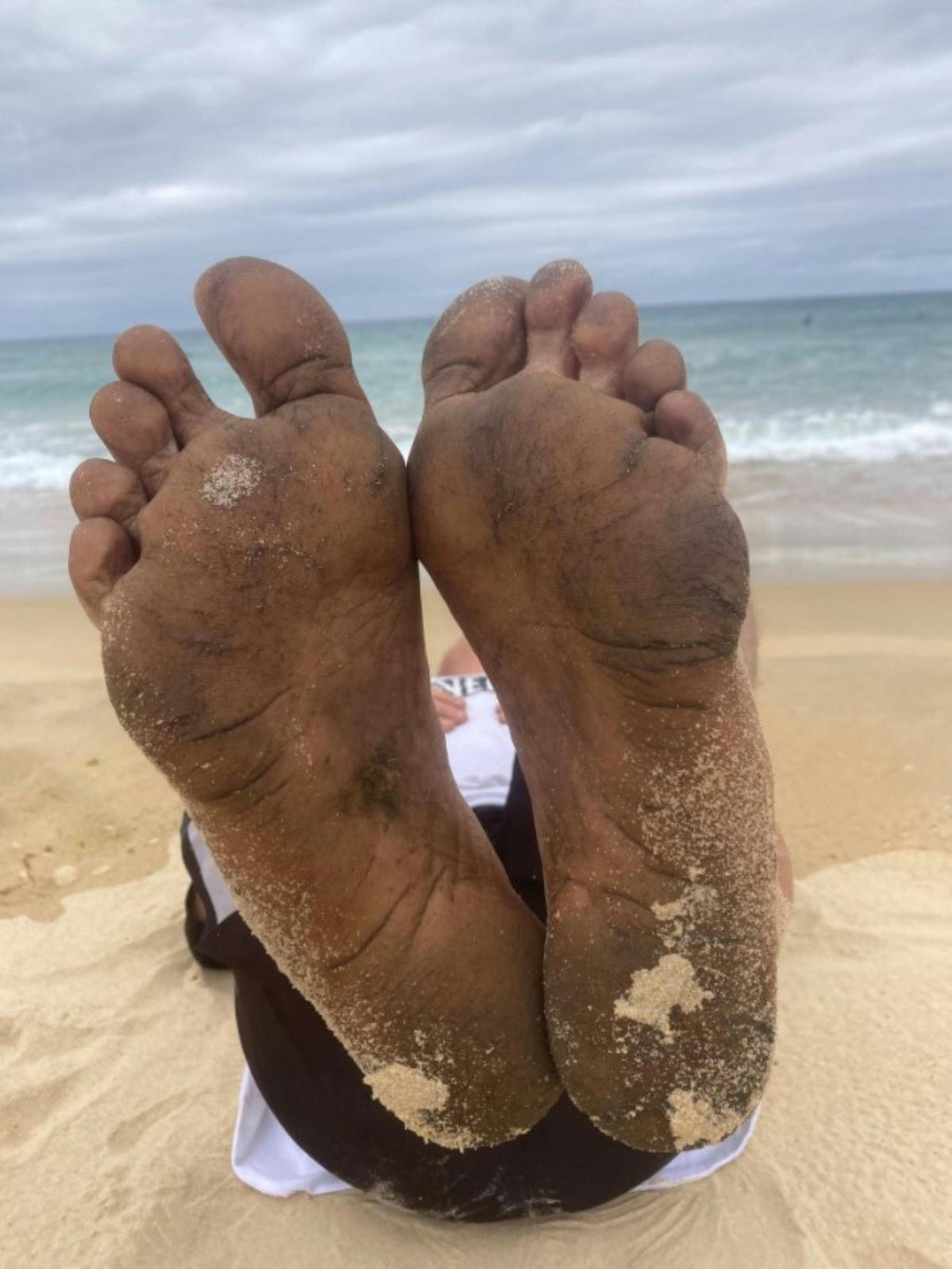 My feet have had a beating , 25KM today on hard packed beach sand  barefoot has taken its toll  OUCH